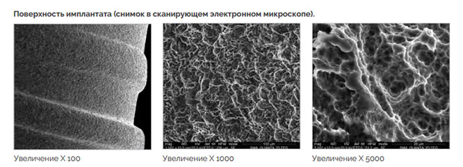 Изображения AlphaBio, полученные с помощью СЭМ (сканирующего электронного микроскопа)