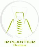 01_dentium_implantium_single